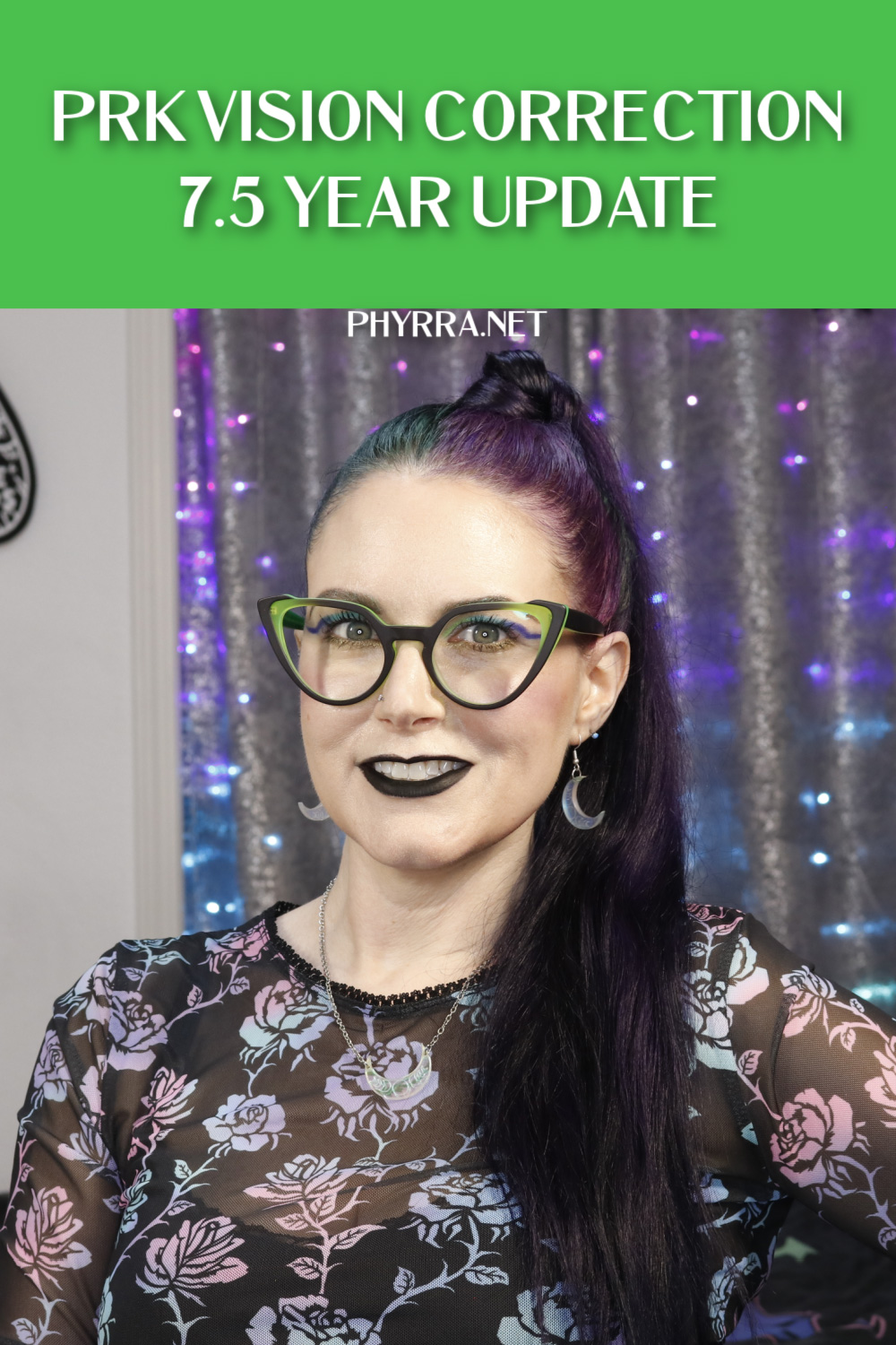 PRK Vision Correction Surgery Update